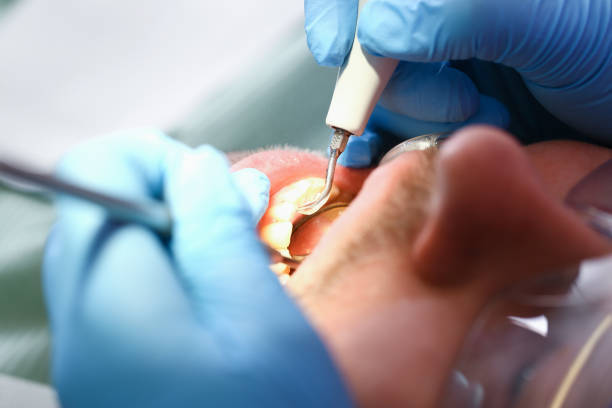 Best Emergency Dental Surgery in Sabetha, KS